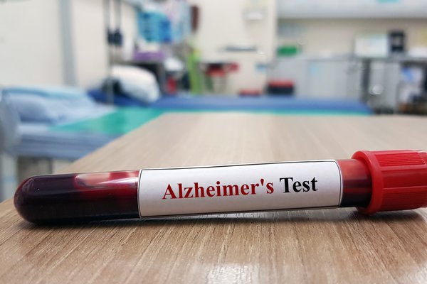 Alzheimer