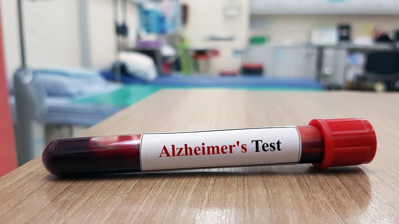 Alzheimer