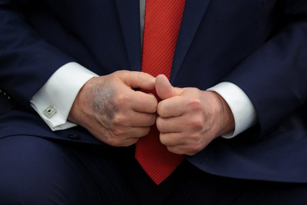 Orðrómur um andlát Trump fer eins og eldur í sinu á samfélagsmiðlum