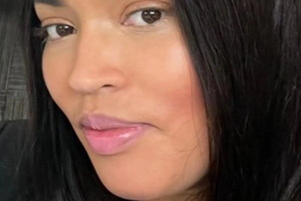 Dularfullt andlát lögreglumanns eftir rassastækkun í rannsókn