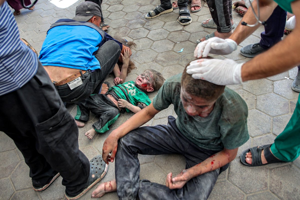 Injured Palestinian children receives treatment outside Baptist Hospital in Gaza City, following an Israeli strike in the central Gaza Strip on July 2, 2025, amid the ongoing conflict between Israel and the Palestinian Hamas militant group. (Photo by Omar AL-QATTAA / AFP)