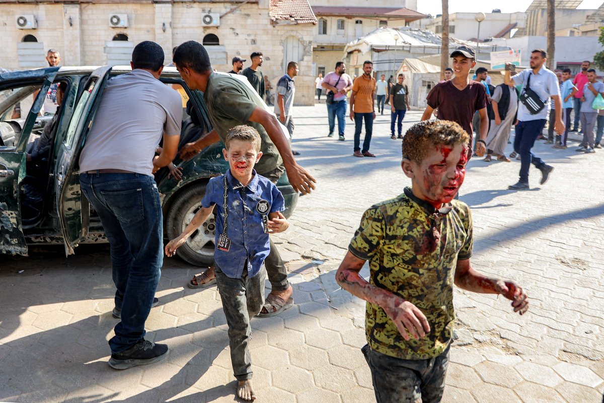 Særð palestínsk börn bregðast við þegar þau koma á sjúkrahús eftir árás Ísraels í Gasa-borg, í miðhluta Gasa, þann 2. júlí 2025